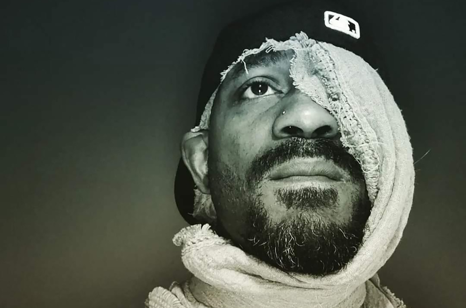 Bump Jonas, SprinkleSumSalt